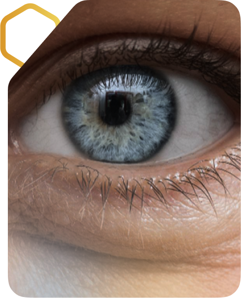 A close-up of an eye with visible under-eye bags and fine lines, framed with a subtle graphic accent.