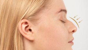 Roman Nose (aquiline nose)