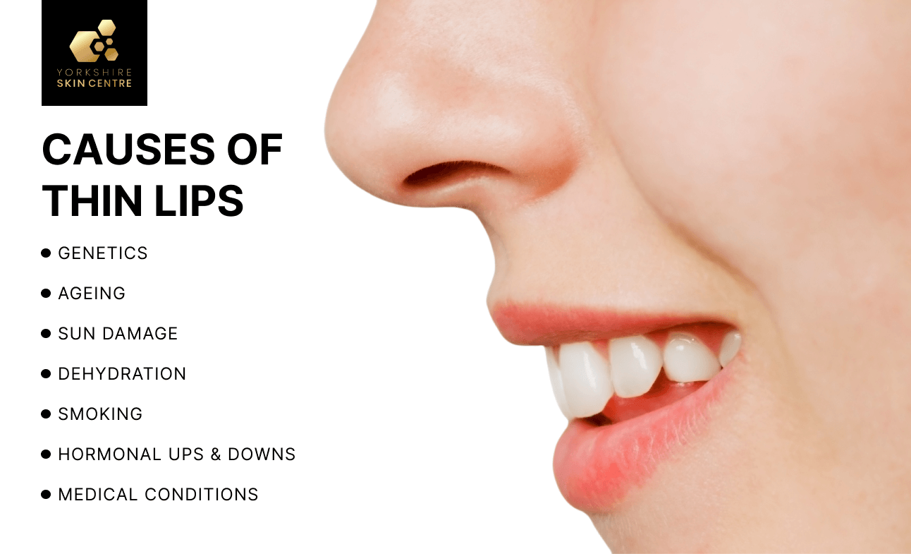 CAUSES OF THIN LIPS