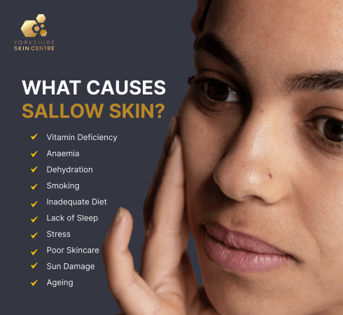 Sallow Skin: Meaning, Signs, & How To Treat It - YSC