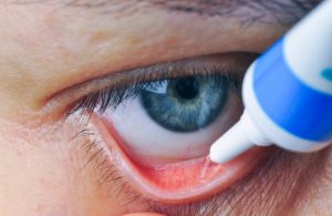Applying ointment after blepharoplasty surgery to soothe and aid healing of the eyelid.