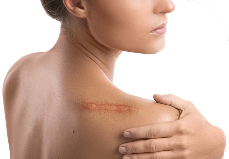 benefit 2 Minimal Scarring