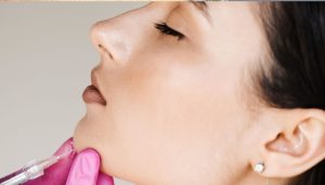 Chin Filler Gone wrong