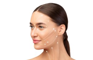 Facetite cost – woman with facial contouring lines showing treatment areas for skin tightening and rejuvenation.