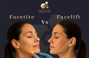 Facetite vs Facelift comparison – non-surgical and surgical facial rejuvenation options at Yorkshire Skin Centre.