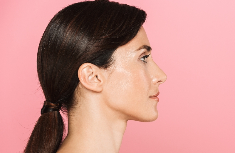 Perfect side profile of a woman showing balanced nose, chin and jawline after facial aesthetics treatment