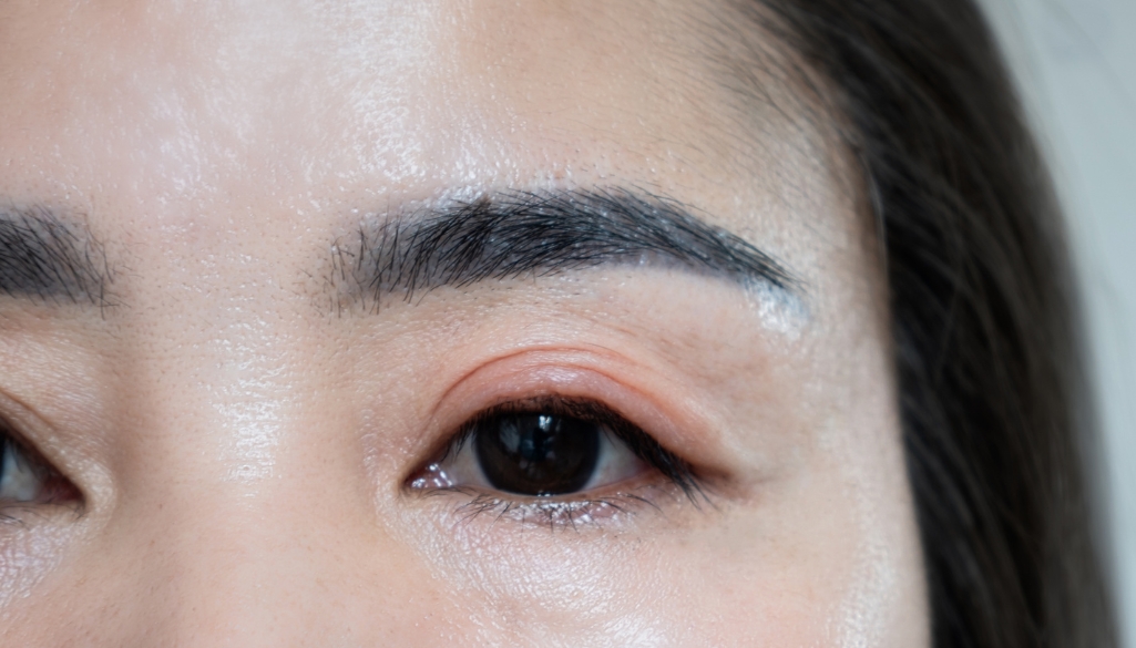 Why Do My Eyelids Feel Heavy? Causes, Symptoms & Treatments