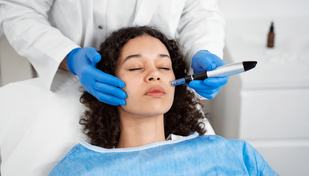Patient undergoing professional microneedling treatment for skin rejuvenation