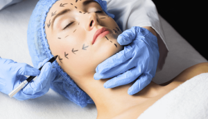 where is sculptra injected shown in picture