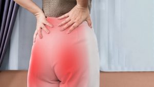 Gluteal sulcus highlighted on the lower buttocks, showing the natural crease beneath the gluteal muscles and its effect on body contour.