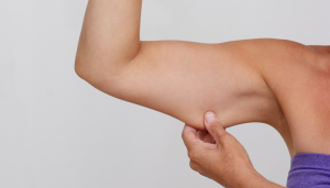 How to get rid of bingo wings