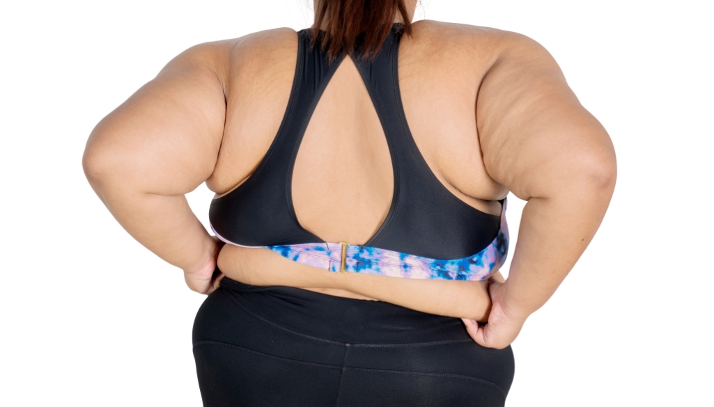 Rear view showing saddlebags on the body, with visible fat deposits around the hips and outer thighs.